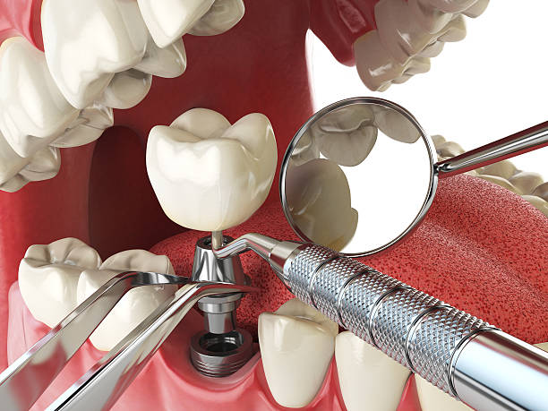 Best Urgent Dental Care for Toothaches in Huntington, WV